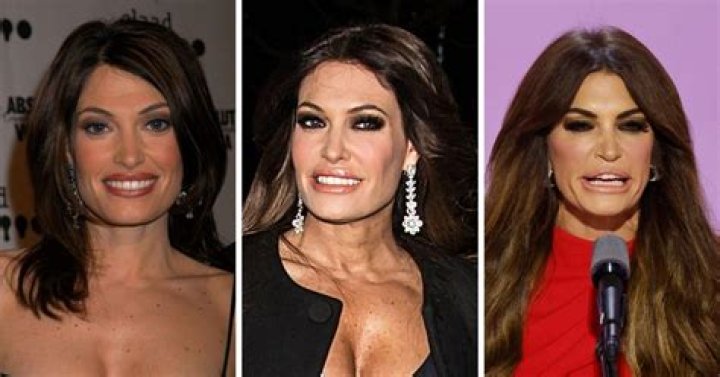 Exploring The Transformation: Guilfoyle Plastic Surgery